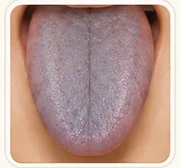 Lengua Azulada