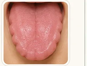 Marcas dentales