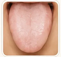 Lengua Pálida