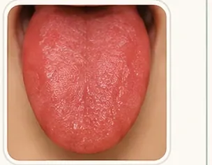 Lengua Roja