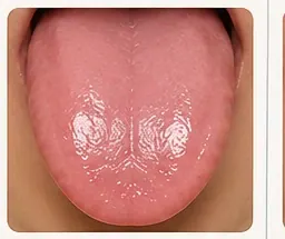 Lengua húmeda