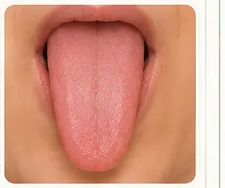 Lengua delgada